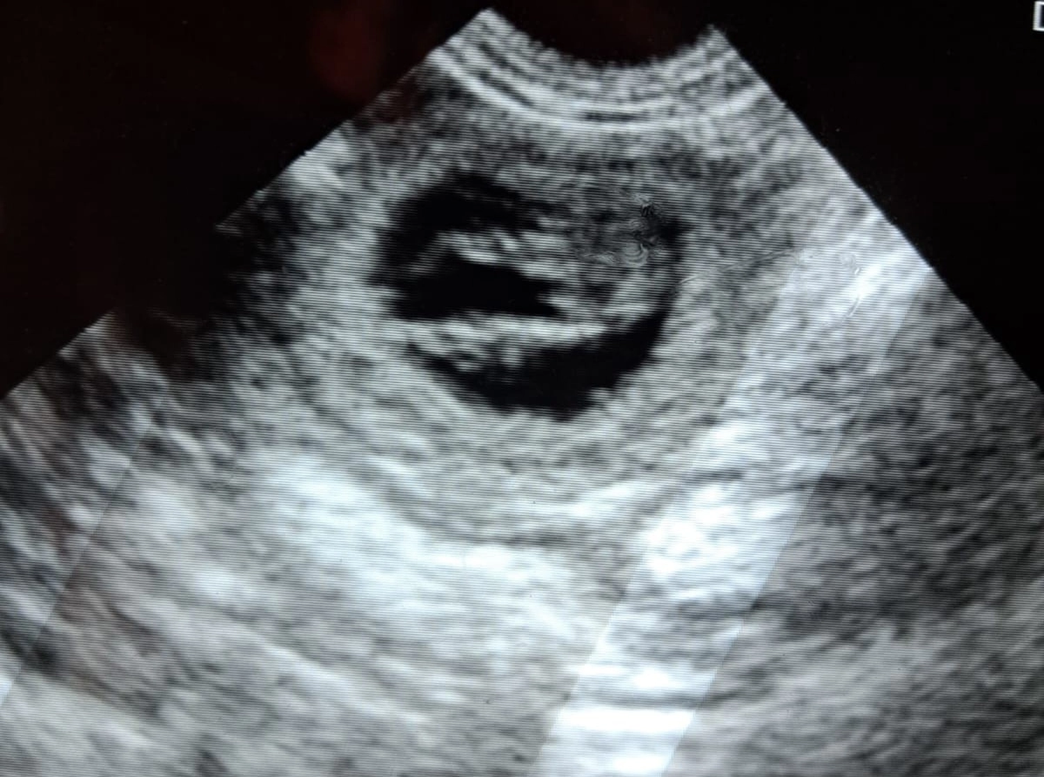 Malinois de la Frisone Liberte - Hundezucht - Ultraschallbericht eines Hundes