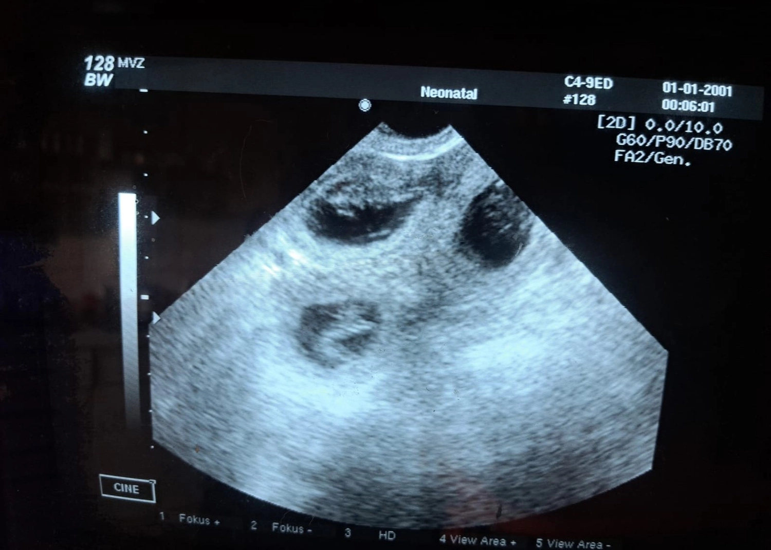 Malinois de la Frisone Liberte - Hundezucht - Ultraschallbericht eines Hundes